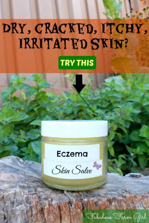 Eczema Skin Salve by FabulousFarmGirl. A soothing remedy for dry, cracked, itchy, irritated skin caused by eczema.